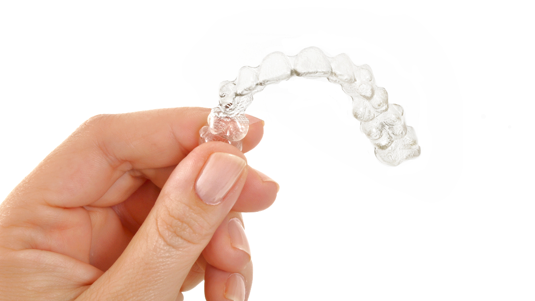 Benefits of SureSmile Clear Braces Alpharetta GA